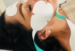 Emfacial Gesichtsstraffung